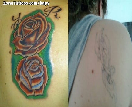 Foto de tatuaje Cover Up, Flores, Rosas