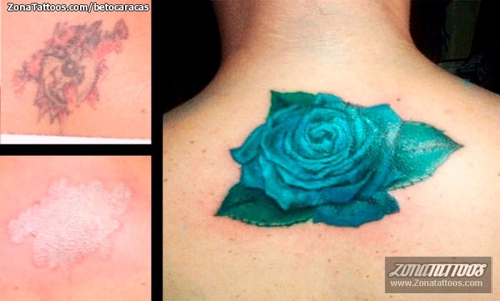 Foto de tatuaje Cover Up, Rosas, Flores